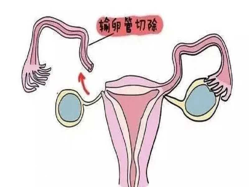 广州哪里可以做供卵试管婴儿