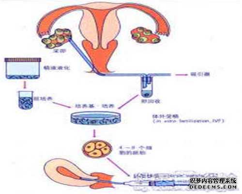 借卵试管代怀价格-中国可以借卵子代怀生子吗-正规代生一个小孩多少钱