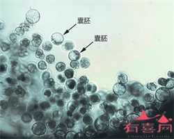 广州供卵助孕三代试管，在优生学和优生学方面男人应该怎么做