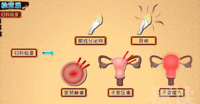 胎停染色体异常治疗，子宫内膜炎要治多久？治疗期间能啪吗？该注意啥？硬核