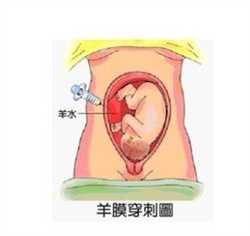 广州医院试管供卵，孕妇梦到下大雨 