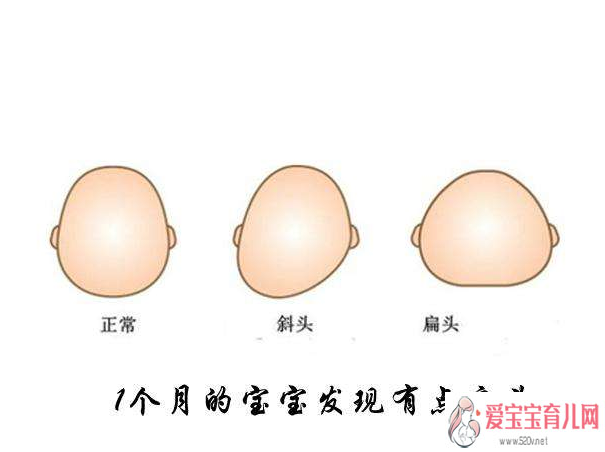 广州代怀产子包性别，孩子扁头会不会影响孩子智力发育孩子睡扁头好还是不好