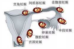 广州供卵医院在哪~广州哪些地方做供卵~广州提供卵巢早衰借卵助孕，为等政策