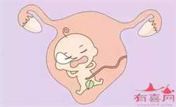 广州借卵包男孩~广州试管供卵机构~，刮宫术对去泰国做试管婴儿有影响吗?