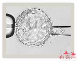 广州供卵代生网~广州借卵生男孩儿~，试管婴儿移植前注意事项有哪些？