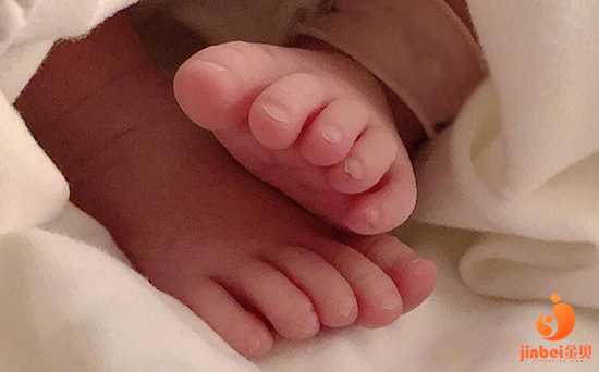 包男孩福州代生机构,【广州供卵机构包男孩】31周顺产女宝宝